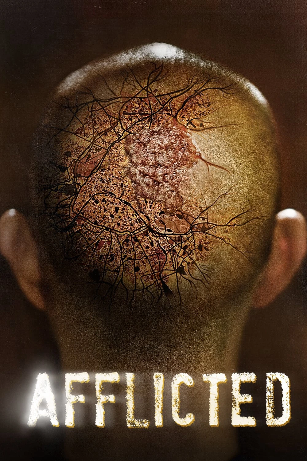 Phim Sức Mạnh Dị Thường - Afflicted (2014)